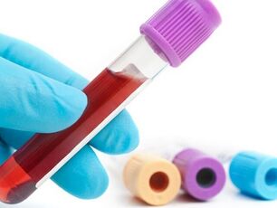 Métodos de laboratorio