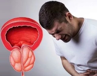 Los síntomas de la prostatitis crónica en los hombres