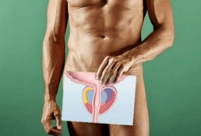 Prostatitis infecciosa aguda